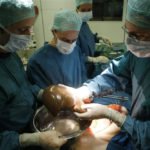 liver transplantation services