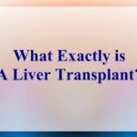 liver transplantation process