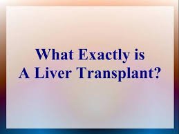 liver transplantation process